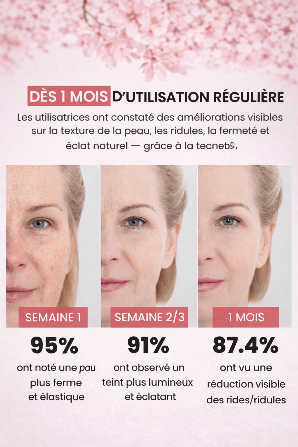 Appareil V-Lift Raffermissant