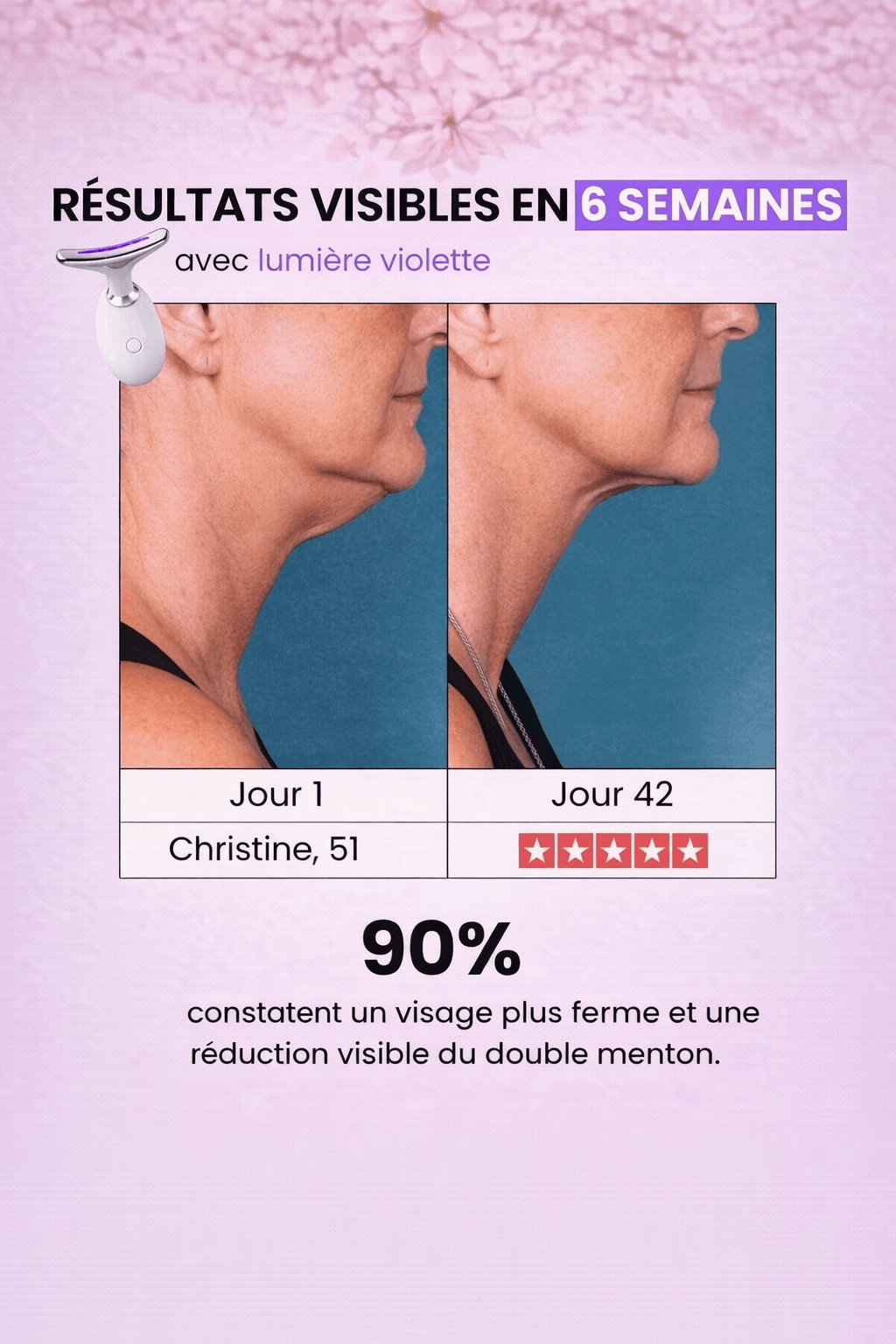 Appareil V-Lift Raffermissant