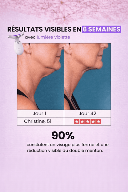 Appareil V-Lift Raffermissant