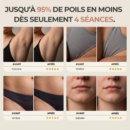 IPL PULSE • ÉPILATEUR À LUMIÈRE PULSÉE