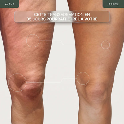 Tonique anti-cellulite X4 Technology