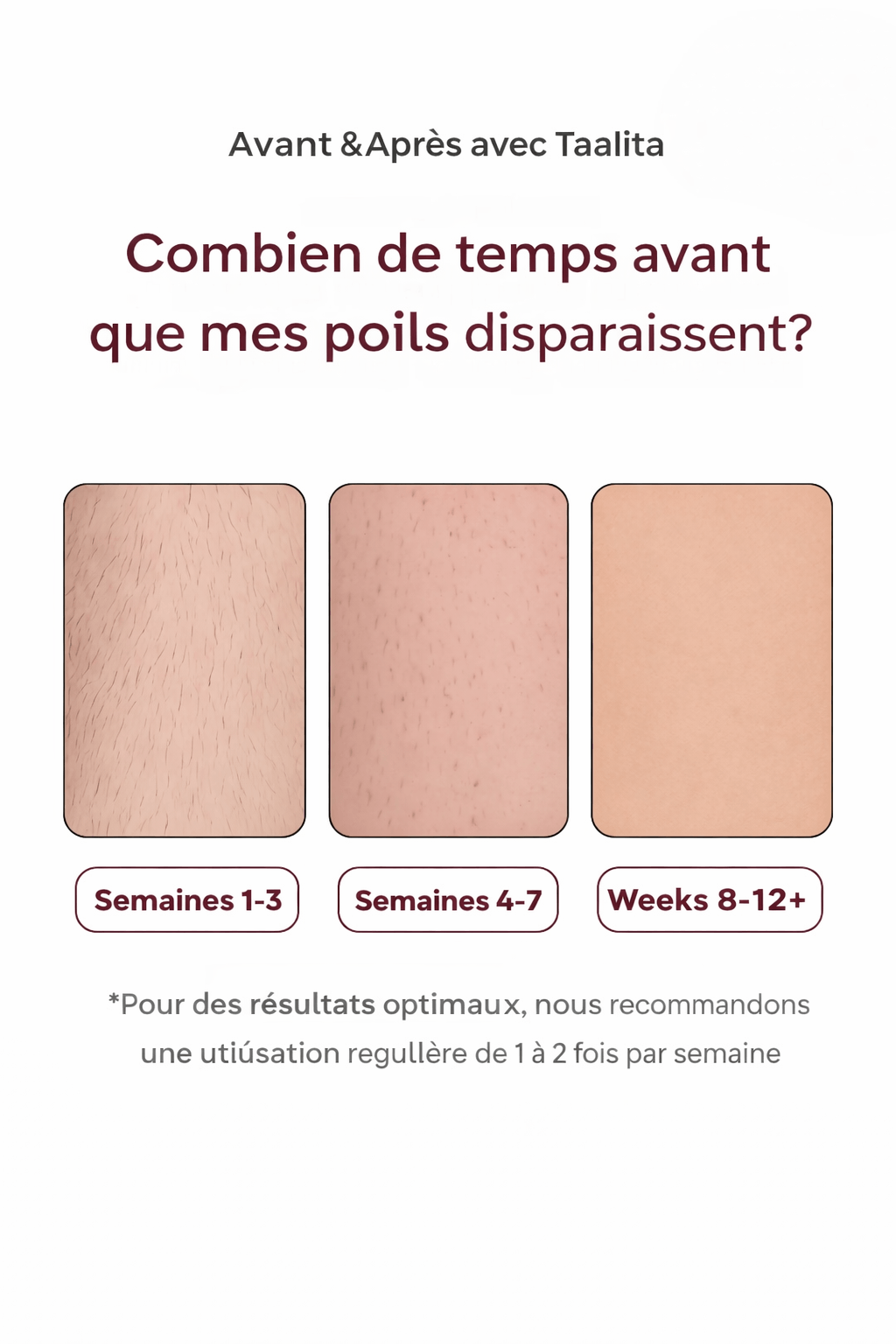Laser IPL Domestique | Le numéro 1 contre les poils.