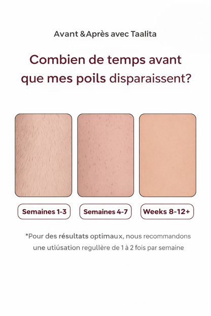 Laser IPL Domestique | Le numéro 1 contre les poils.