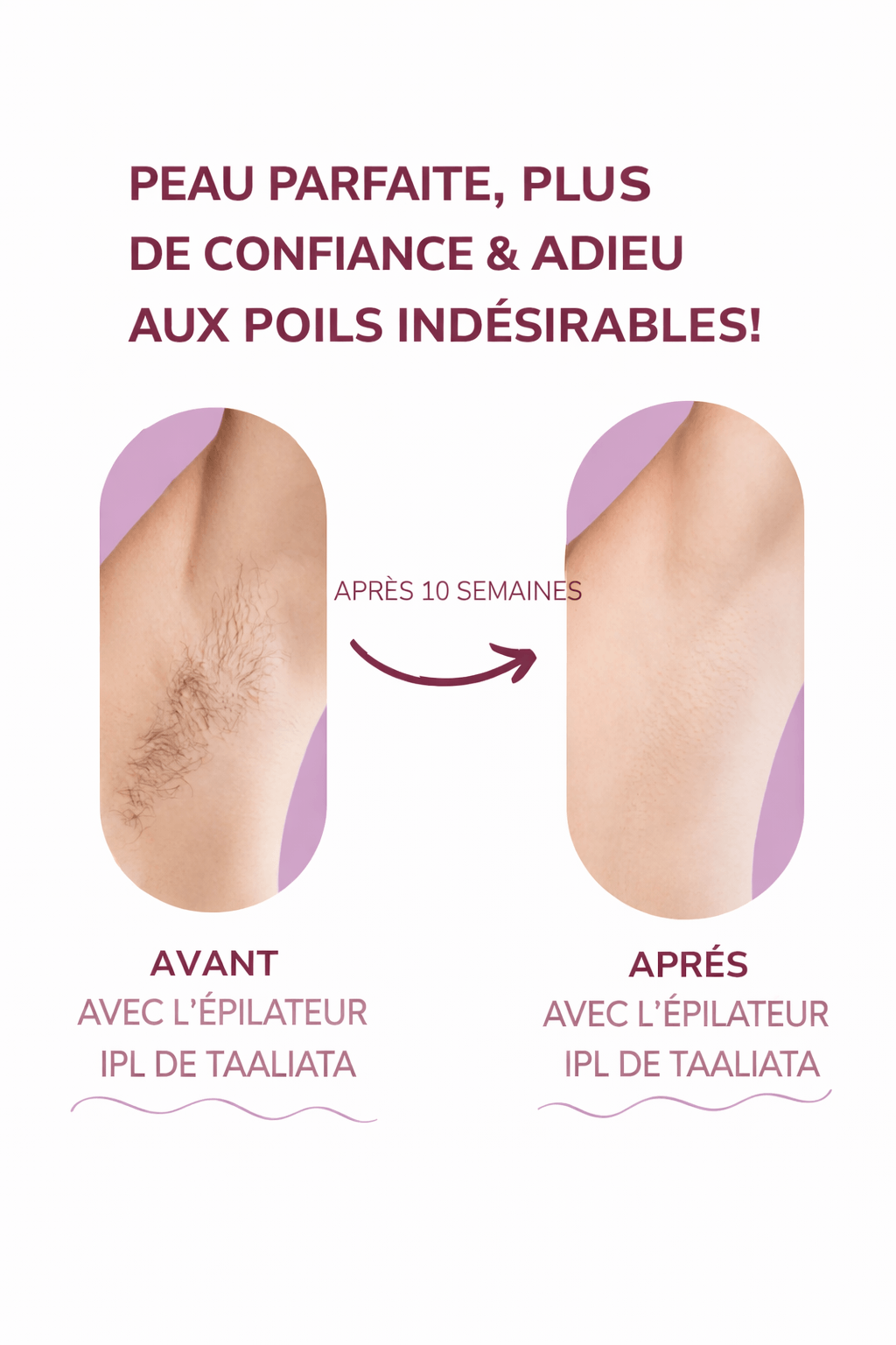 Laser IPL Domestique | Le numéro 1 contre les poils.
