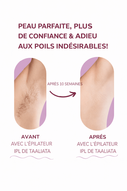 Laser IPL Domestique | Le numéro 1 contre les poils.