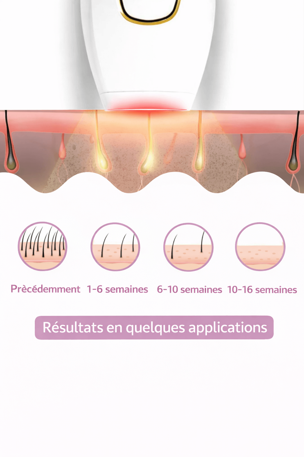 Laser IPL Domestique | Le numéro 1 contre les poils.