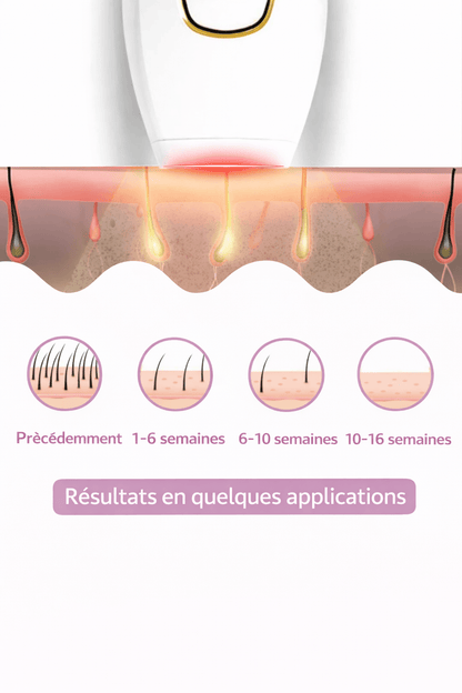 Laser IPL Domestique | Le numéro 1 contre les poils.